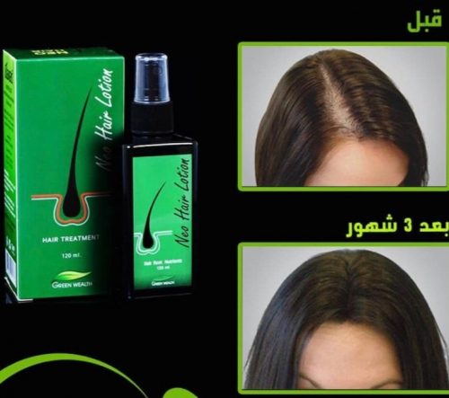 تجربتي مع نيو هير لوشن