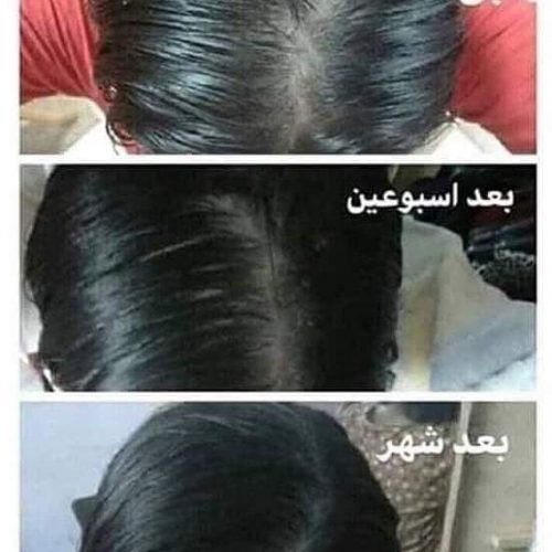 نتيجة سورسير للشعر